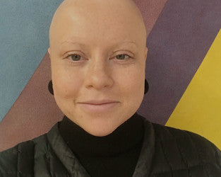 5 Things No One Tells You About Losing Your Hair During Cancer Treatment